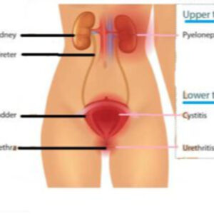 s5e7: “do you have urinary symptoms related to long covid?”